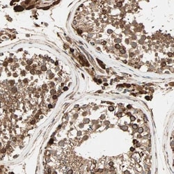 P4HA1 Antibody, Novus Biologicals 0.1mL; Unlabeled:Antibodies, Polyclonal