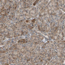 P4HA1 Antibody, Novus Biologicals 0.1mL; Unlabeled:Antibodies, Polyclonal