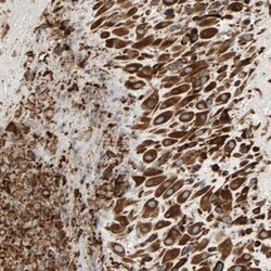 P4HA1 Antibody, Novus Biologicals 0.1mL; Unlabeled:Antibodies, Polyclonal