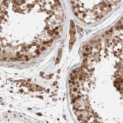 P4HA1 Antibody, Novus Biologicals 0.1mL; Unlabeled:Antibodies, Polyclonal