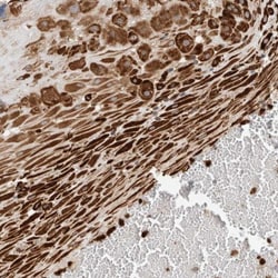 P4HA1 Antibody, Novus Biologicals 0.1mL; Unlabeled:Antibodies, Polyclonal