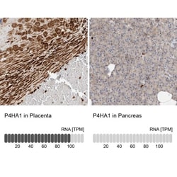 P4HA1 Antibody, Novus Biologicals 0.1mL; Unlabeled:Antibodies, Polyclonal