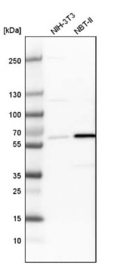 P4HA1 Antibody, Novus Biologicals 0.1mL; Unlabeled:Antibodies, Polyclonal