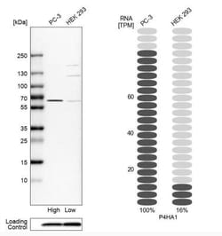 P4HA1 Antibody, Novus Biologicals 0.1mL; Unlabeled:Antibodies, Polyclonal