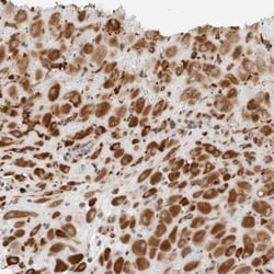 P4HA2 Antibody, Novus Biologicals 25 &mu;L, Unlabeled:Antibodies, Polyclonal