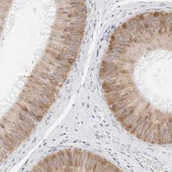 P4HA2 Antibody, Novus Biologicals 25 &mu;L, Unlabeled:Antibodies, Polyclonal