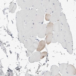 P4HA2 Antibody, Novus Biologicals 25 &mu;L, Unlabeled:Antibodies, Polyclonal