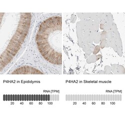 P4HA2 Antibody, Novus Biologicals 25 &mu;L, Unlabeled:Antibodies, Polyclonal