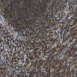 PA28 Activator alpha Subunit/PSME1 Antibody, Novus Biologicals 0.1mL; Unlabeled:Antibodies,