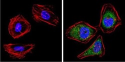 PA28 Activator beta Subunit/PSME2 Antibody, Novus Biologicals 100 &mu;L;