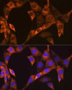 PA2G4/EBP1 Rabbit anti-Human, Mouse, Rat, Clone: 9J9U5, Novus Biologicals:Antibodies:Primary