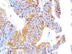 PA2G4/EBP1 Rabbit anti-Human, Mouse, Rat, Clone: 9J9U5, Novus Biologicals:Antibodies:Primary