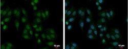 PABPN1 Antibody, Novus Biologicals 0.1mL; Unlabeled:Antibodies, Polyclonal