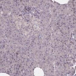 PAC1R Antibody, Novus Biologicals 0.1mL; Unlabeled:Antibodies, Polyclonal