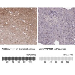 PAC1R Antibody, Novus Biologicals 0.1mL; Unlabeled:Antibodies, Polyclonal
