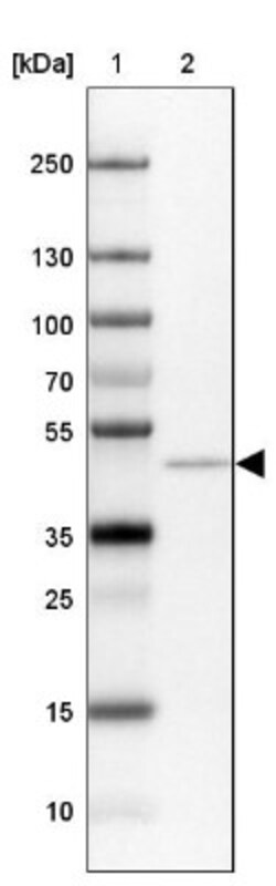 PAC1R Antibody, Novus Biologicals 0.1mL; Unlabeled:Antibodies, Polyclonal