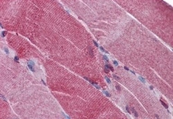 PACE4/PCSK6 Antibody, Novus Biologicals 0.1mg; Unlabeled:Antibodies, Polyclonal