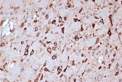 PACT Rabbit anti-Human, Mouse, Rat, Clone: 2W2E10, Novus Biologicals:Antibodies:Primary