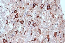PACT Rabbit anti-Human, Mouse, Rat, Clone: 2W2E10, Novus Biologicals:Antibodies:Primary