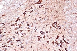PACT Rabbit anti-Human, Mouse, Rat, Clone: 2W2E10, Novus Biologicals:Antibodies:Primary