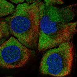 PADI1 Antibody, Novus Biologicals 25 &mu;L:Antibodies, Polyclonal