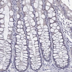 PADI1 Antibody, Novus Biologicals 25 &mu;L:Antibodies, Polyclonal