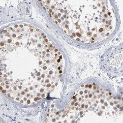 PAGE1 Antibody, Novus Biologicals 0.1mL; Unlabeled:Antibodies, Polyclonal