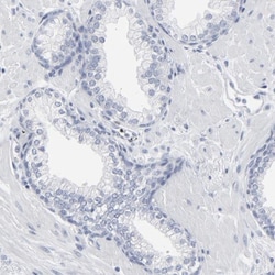 PAGE1 Antibody, Novus Biologicals 0.1mL; Unlabeled:Antibodies, Polyclonal