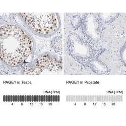 PAGE1 Antibody, Novus Biologicals 0.1mL; Unlabeled:Antibodies, Polyclonal