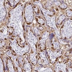 PAGE4 Antibody, Novus Biologicals 25 &mu;L; Unlabeled:Antibodies, Polyclonal