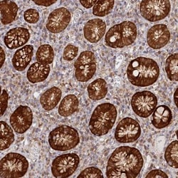PAIP2 Antibody, Novus Biologicals:Antibodies:Primary Antibodies
