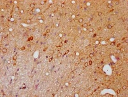PAK1/2/3, p Ser144, p Ser141, p Ser139 Antibody (3H12), Novus Biologicals