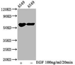 PAK1/2/3, p Ser144, p Ser141, p Ser139 Antibody (3H12), Novus Biologicals