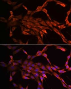 PAK1 Rabbit anti-Human, Mouse, Rat, Clone: 6R3M5, Novus Biologicals 100 &mu;g | Buy Online | Novus Biologicals | Fisher Scientific