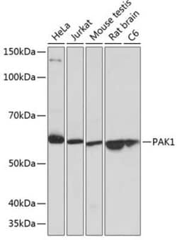 PAK1 Rabbit anti-Human, Mouse, Rat, Clone: 6R3M5, Novus Biologicals 100 &mu;g | Buy Online | Novus Biologicals | Fisher Scientific