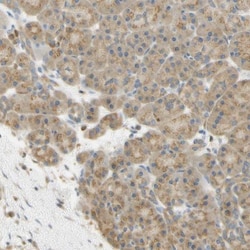 PAK1 Antibody, Novus Biologicals:Antibodies:Primary Antibodies