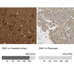 PAK1 Antibody, Novus Biologicals:Antibodies:Primary Antibodies