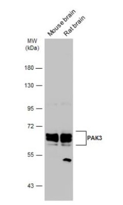 PAK3 Antibody, Novus Biologicals 0.1mL; Unlabeled:Antibodies, Polyclonal