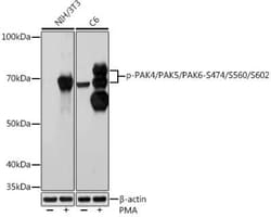 PAK4+5+6 Rabbit anti-Human, Mouse, Rat, Clone: 4E1H7, Novus Biologicals