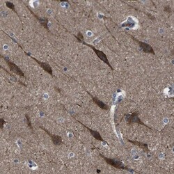 PAK7 Antibody, Novus Biologicals 25 &mu;L; Unlabeled:Antibodies, Polyclonal