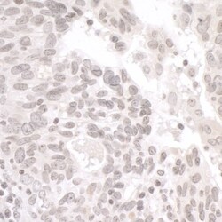 PALB2 Antibody, Novus Biologicals 0.1mg; Unlabeled:Antibodies, Polyclonal