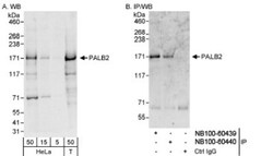 PALB2 Antibody, Novus Biologicals 0.1mg; Unlabeled:Antibodies, Polyclonal