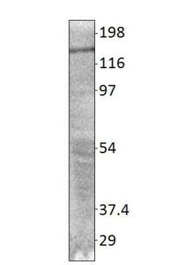 PALB2 Antibody, Novus Biologicals 100 &mu;g; Unconjugated:Antibodies, Polyclonal
