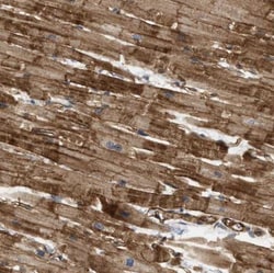 PALMD Antibody, Novus Biologicals:Antibodies:Primary Antibodies