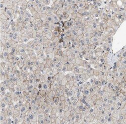PALMD Antibody, Novus Biologicals:Antibodies:Primary Antibodies