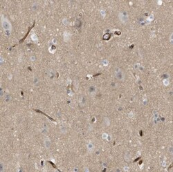 PALMD Antibody, Novus Biologicals:Antibodies:Primary Antibodies