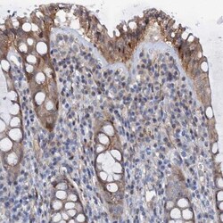 PAMCI Antibody, Novus Biologicals 0.1mL; Unlabeled:Antibodies, Polyclonal