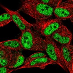 PANP/PILR alpha associated neural protein Antibody, Novus Biologicals 25