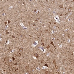 PANP/PILR alpha associated neural protein Antibody, Novus Biologicals 25