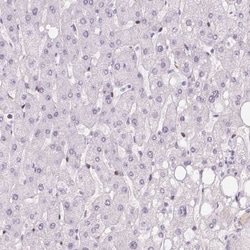 PANP/PILR alpha associated neural protein Antibody, Novus Biologicals 25